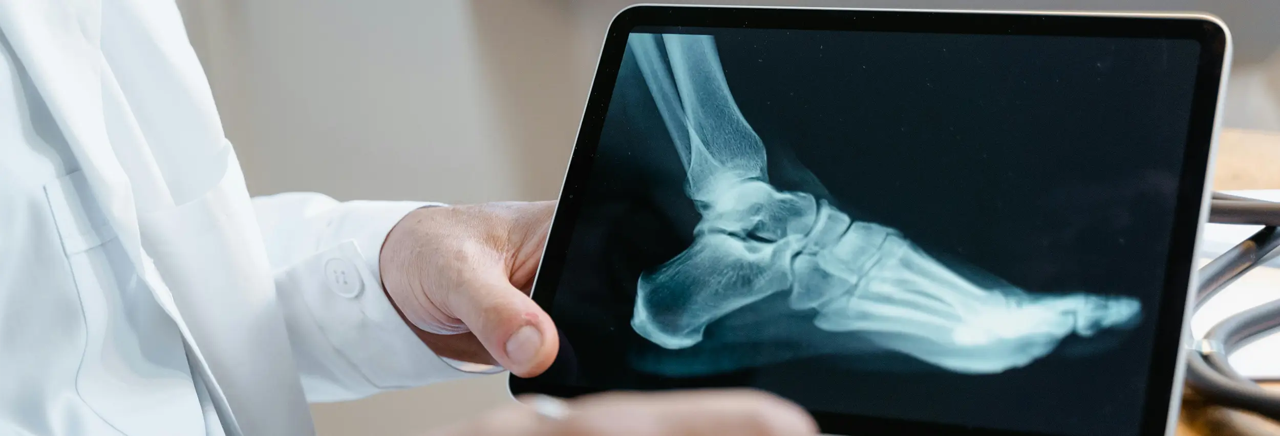 Digital XRAY of foot that doctor is holding